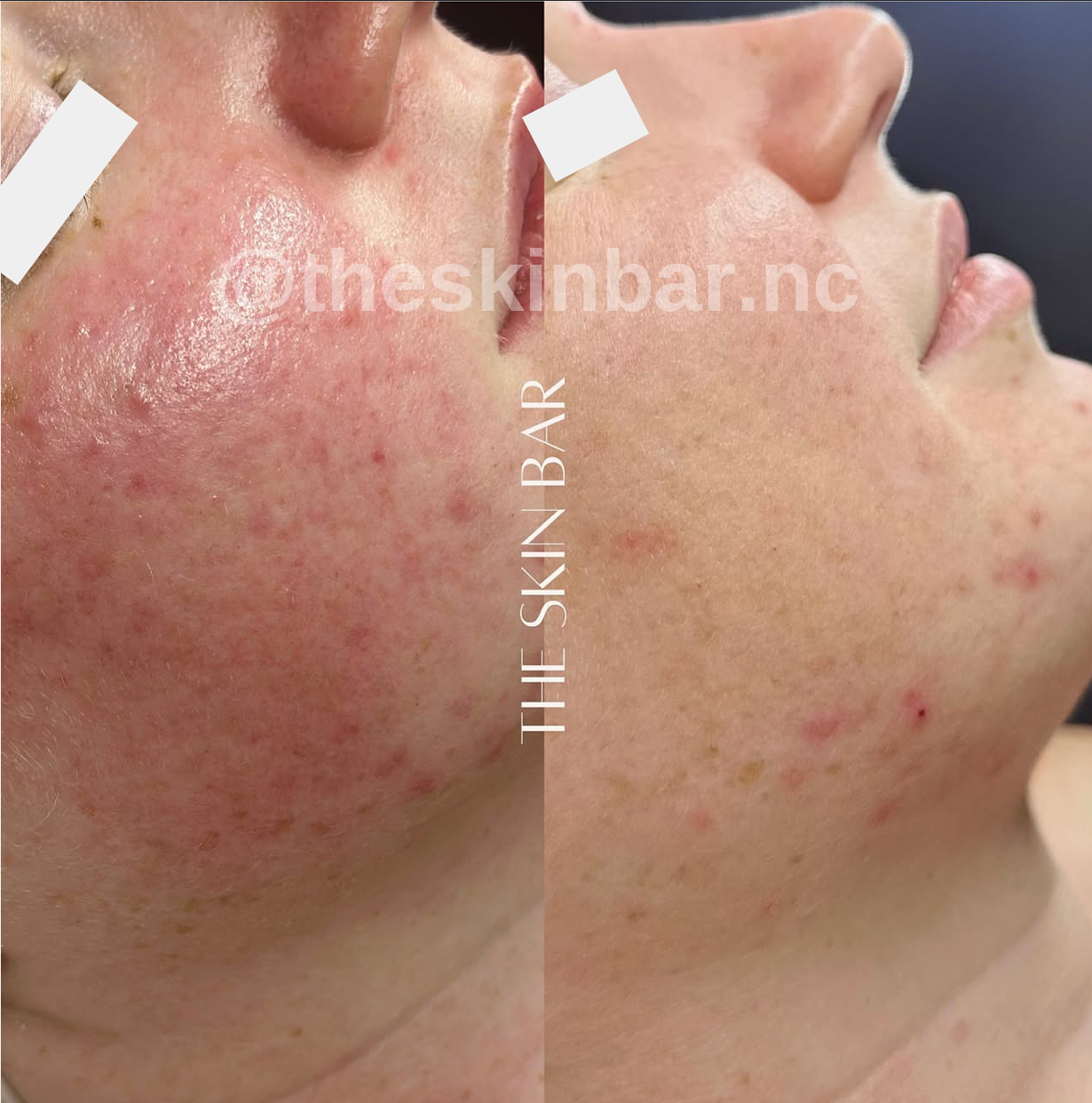 SIV Biome Balancing Serum