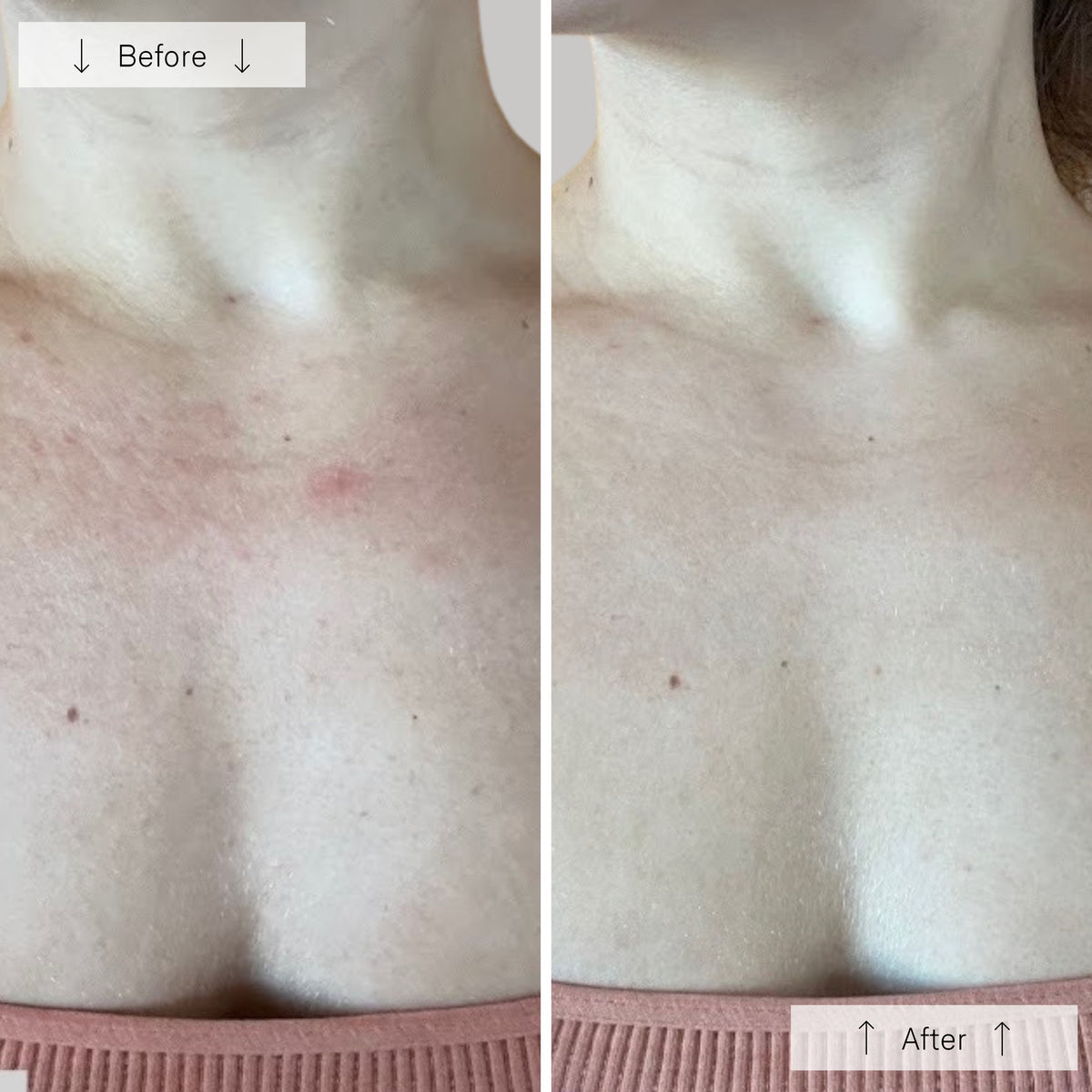 Omnilux Contour Neck and Deécolleté