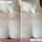 Omnilux Contour Neck and Deécolleté