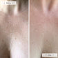 Omnilux Contour Neck and Deécolleté