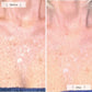 Omnilux Contour Neck and Deécolleté