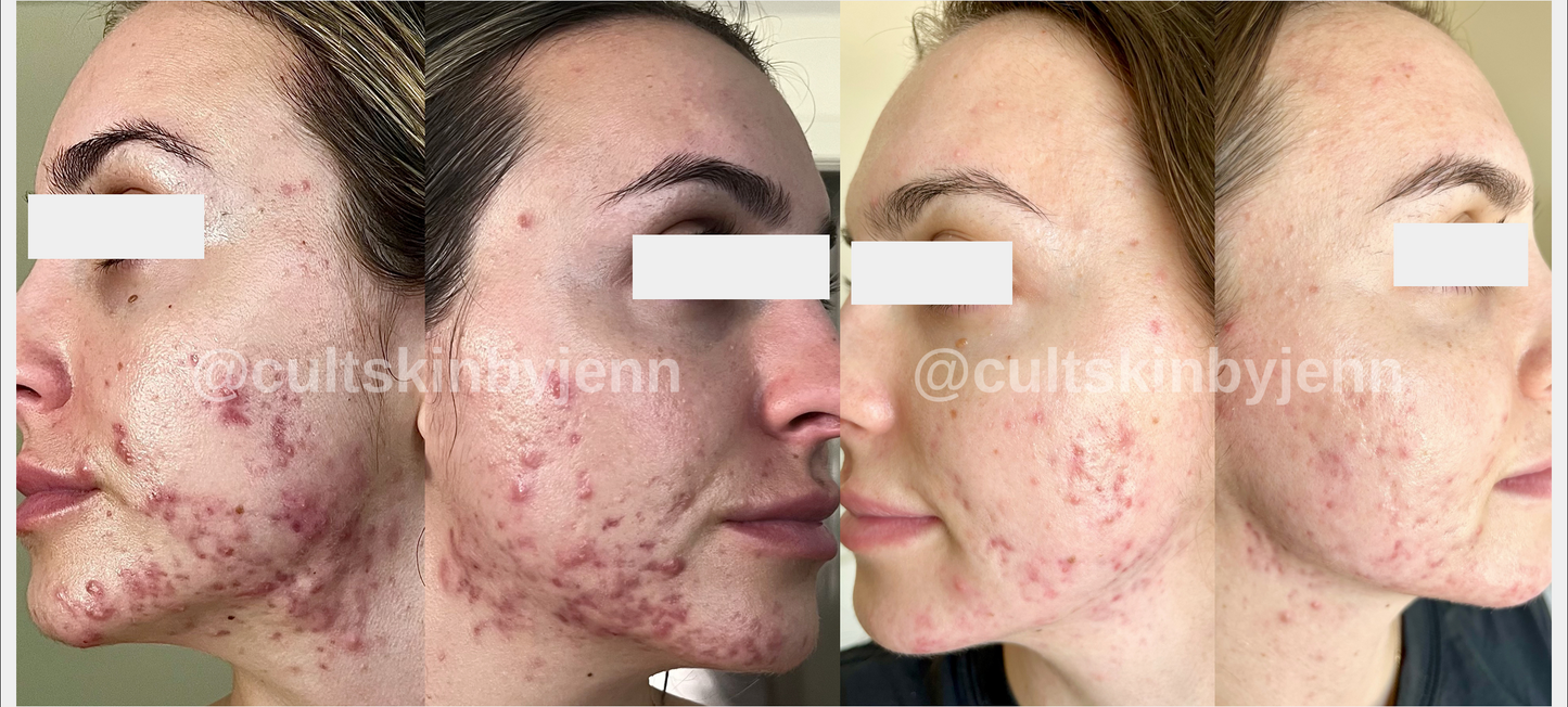 SIV Biome Balancing Serum