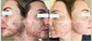 SIV Biome Balancing Serum