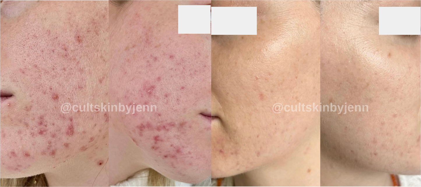 SIV Biome Balancing Serum
