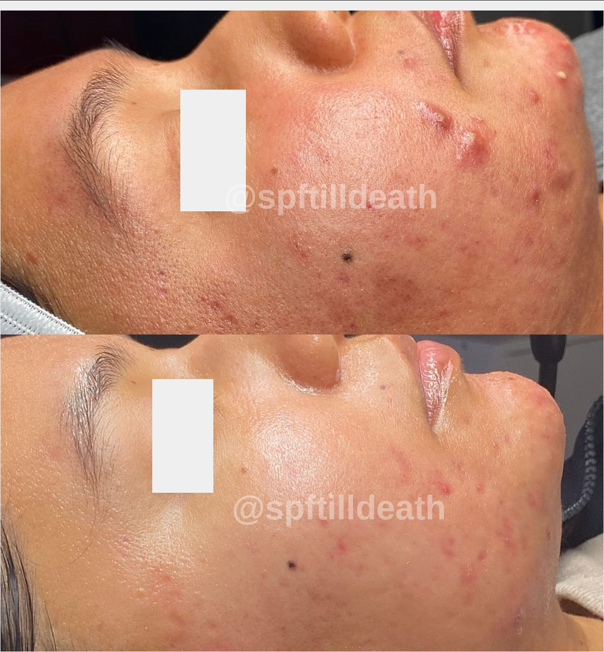 SIV Biome Balancing Serum