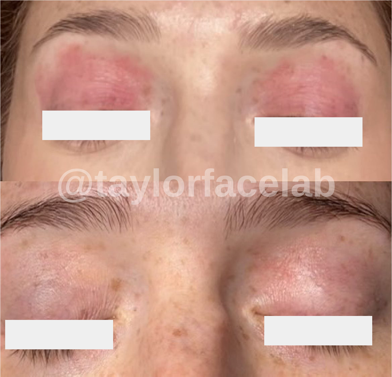 SIV Biome Balancing Serum