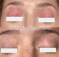 SIV Biome Balancing Serum