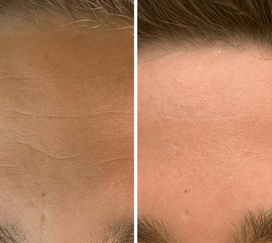 Omnilux Men LED Light Therapy Mask