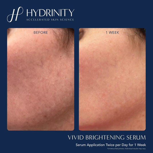 Hydrinity Vivid Brightening Serum